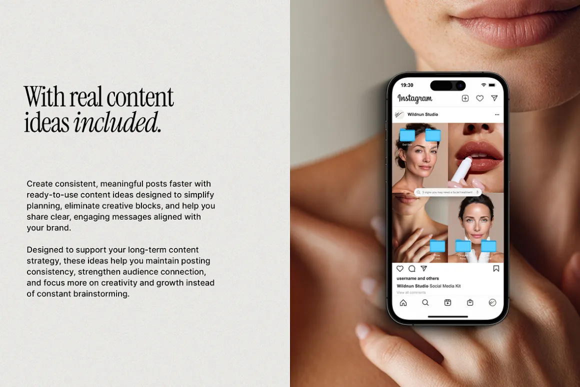 2026 Botox and Filler Instagram